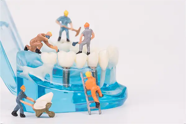 A miniature team of toy construction workers conduct repairs on a transparent dental model with a dental implant bridge, a visual metaphor for dental implant restoration.